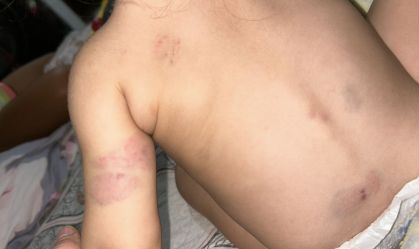 Bebê sofre agressões de outras crianças em creche no Rio; família alega omissão de socorro