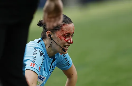 Bandeirinha é atingida por câmera em jogo da LALIGA