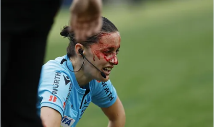 Bandeirinha é atingida por câmera em jogo da LALIGA