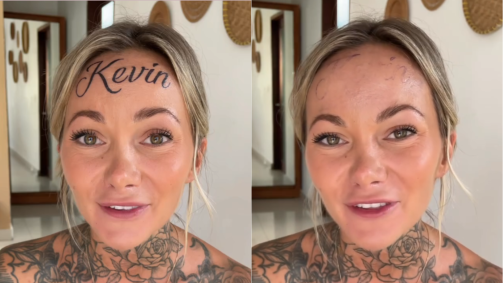 Mulher que viralizou ao tatuar nome do namorado na testa revela