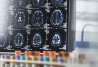 O que faz o cérebro envelhecer mais rápido? Novo estudo indica fatores de risco