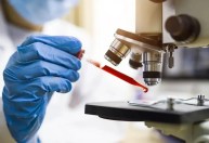 HIV: saiba quais testes existem no Brasil e entenda como são feitos