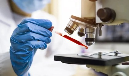 Proteínas encontradas no sangue podem indicar câncer com 7 anos de antecedência