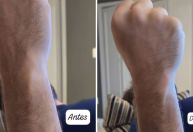 Kayky Brito mostra resultado de fisioterapia no braço: &quot;Não desista&quot;