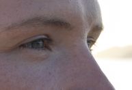 Médicos alertam sobre riscos para saúde dos olhos durante Carnaval