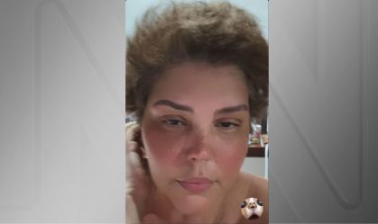 Simony mostra crescimento do cabelo após tratamento de câncer; veja