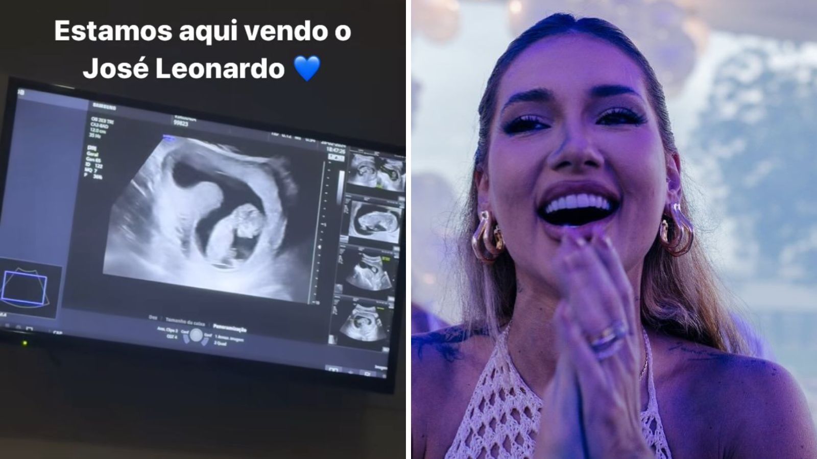 Virginia Fonseca compartilha ultrassom de José Leonardo