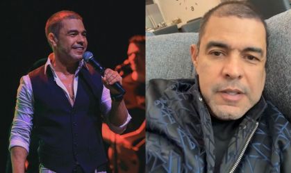 Zezé Di Camargo respondeu dúvidas de internautas quanto ao seu transplante capilar
