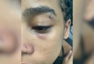 Artista de rua diz que foi agredida por seguranças da CPTM em São Paulo