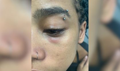 Artista de rua diz que foi agredida por seguranças da CPTM em São Paulo