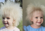 Conheça a síndrome do cabelo impenteável