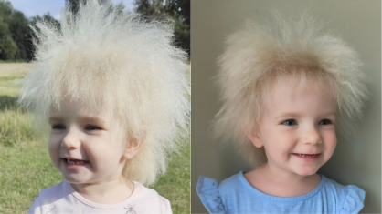 Síndrome do Cabelo Impentiável é comentada no Instagram a partir do perfil da menina Layla Davis