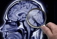 Alzheimer: IA identifica fatores de risco com 7 anos de antecedência