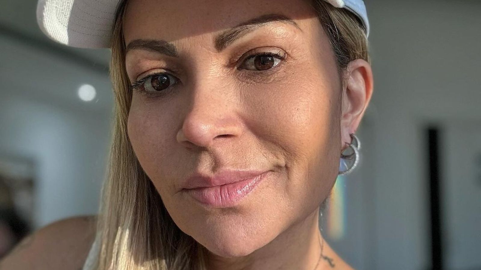 Solange Almeida tranquiliza fãs após cirurgia