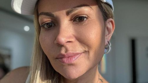 Solange Almeida tranquiliza fãs após cirurgia