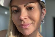 Solange Almeida tranquiliza fãs após cirurgia: 