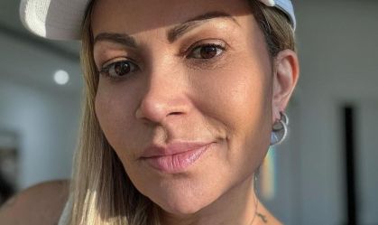 Solange Almeida tranquiliza fãs após cirurgia