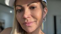 Solange Almeida tranquiliza fãs após cirurgia: "Bem cuidada"