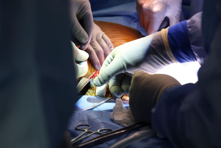 Médicos realizam o primeiro transplante de rim de porco em um paciente humano vivo / MASSACHUSETTS GENERAL HOSPITAL/Divulgação