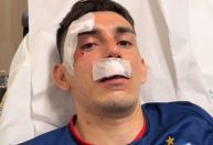 Relembre o ataque da torcida do Sport contra jogadores do Fortaleza