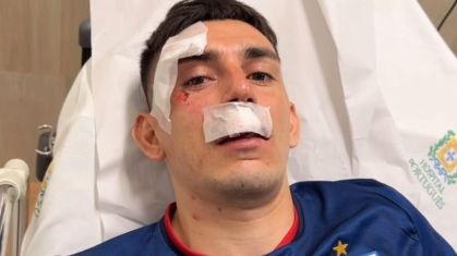 Gonzalo Escobar após atentado