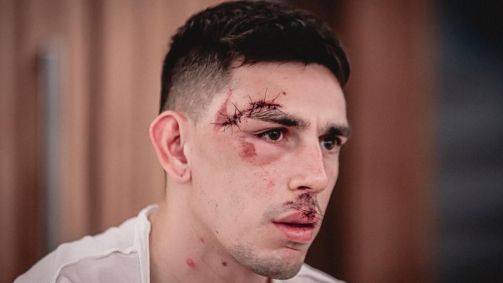 Gonzalo Escobar após atentado
