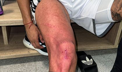Imagem de destaque do post: Atlético-MG dispara contra arbitragem após entrada de Fagner em Zaracho: "Cadê o VAR?"