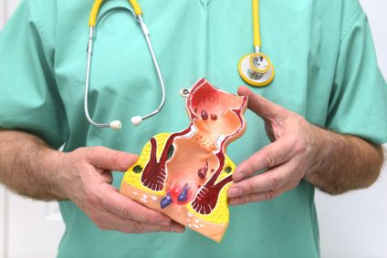 Cirurgião segurando um modelo em 3D do reto