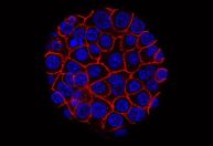 Como fazer detecção precoce do câncer de pâncreas? Cientistas buscam alternativas