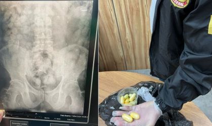 Venezuelano é preso no Pará com mais de 150 cápsulas de cocaína no estômago