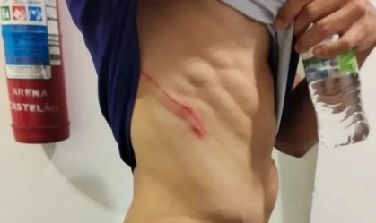 Funcionário do Ceará faz BO e acusa atacante do Fortaleza de agressão