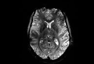 Máquina de ressonância revela 1ª imagem do cérebro humano com alta precisão