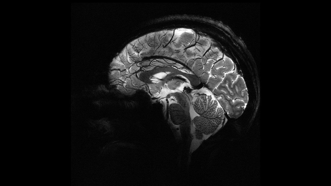 cerebro-humano-de-lado