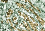 EUA confirmam segundo caso de gripe aviária em humano