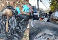 Ratazanas e crânio humano: pais relatam insegurança e sujeira perto de berçário em SP