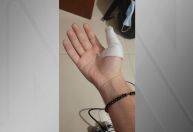 Passageiro sofre ferimentos nas mãos ao ser esbarrado pelo trem no metrô de São Paulo
