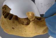 Por que nossos ancestrais não tinham cáries? Novo estudo ajuda a explicar