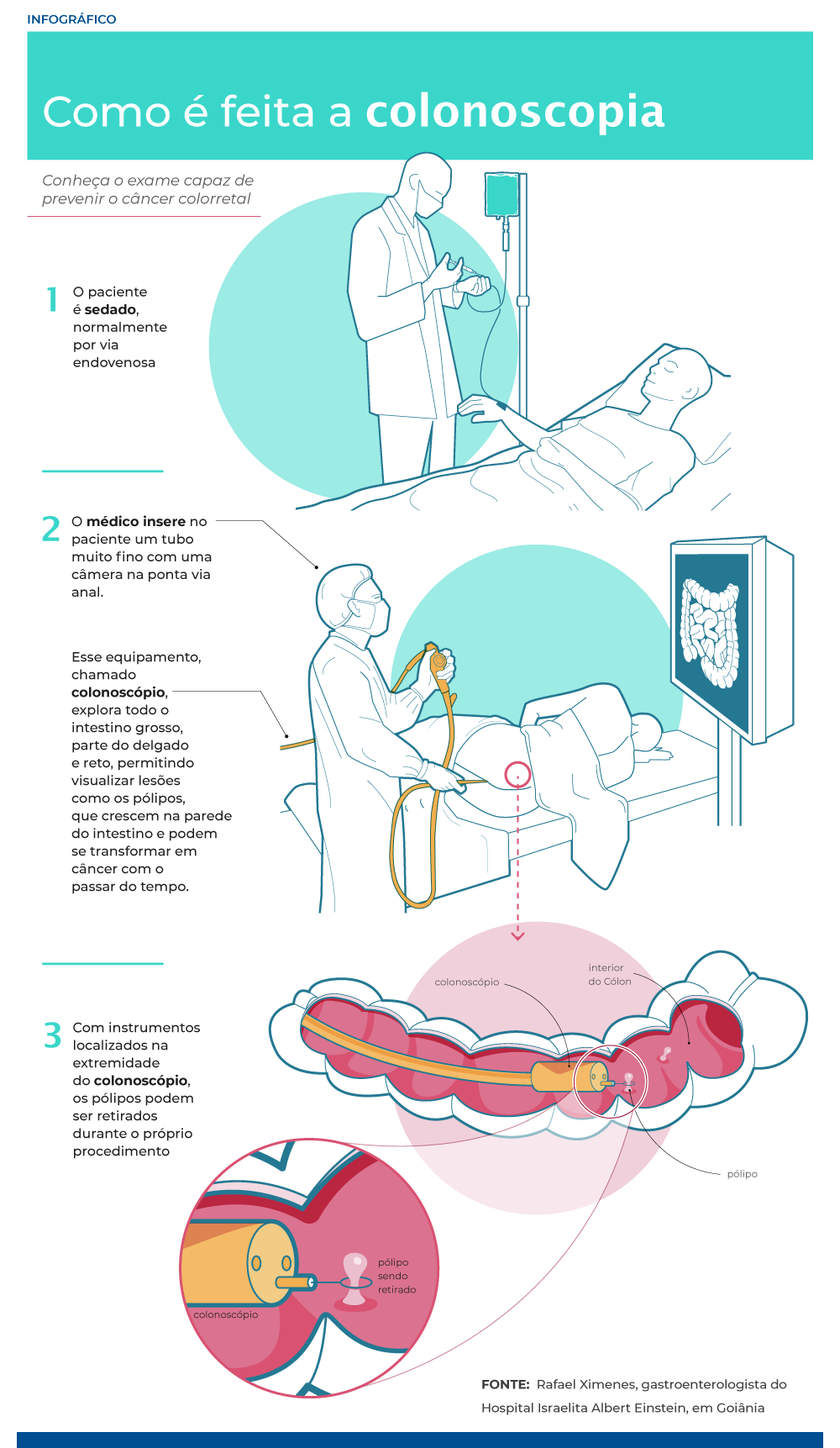 Saiba como é feito o exame de prevenir o câncer colorretal / Agência Einstein/Rafael Ximenes/Reprodução