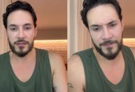 Eliezer desfaz harmonização facial: 