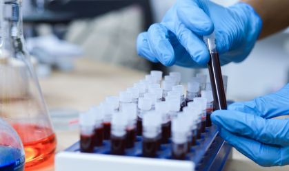 Exame de sangue pode diagnosticar ELA com 98% de precisão, diz estudo