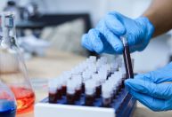 Exame de sangue com IA realiza detecção precoce de nove tipos de câncer