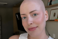 Fabiana Justus reflete sobre queda de cabelo: 