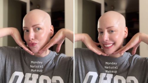 Fabiana Justus foi diagnosticada com leucemia no início do ano