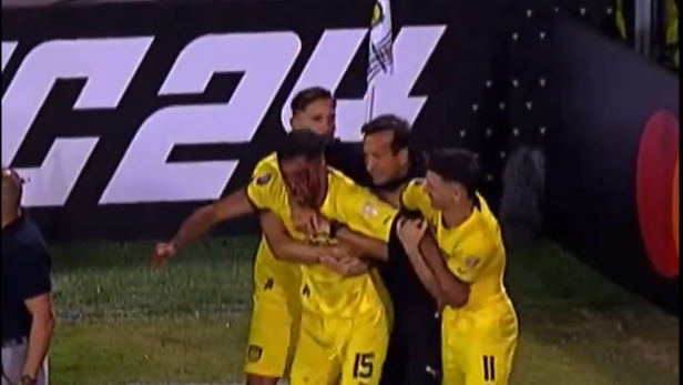 Jogador do Peñarol foi atingido ao fim do jogo contra o Rosario