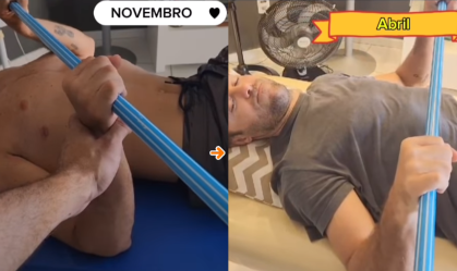 Kayky Brito compartilha antes e depois da fisioterapia 7 meses após acidente