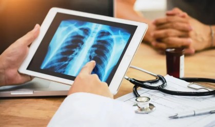 Dia Mundial da Tuberculose: saiba como é feito o diagnóstico da doença