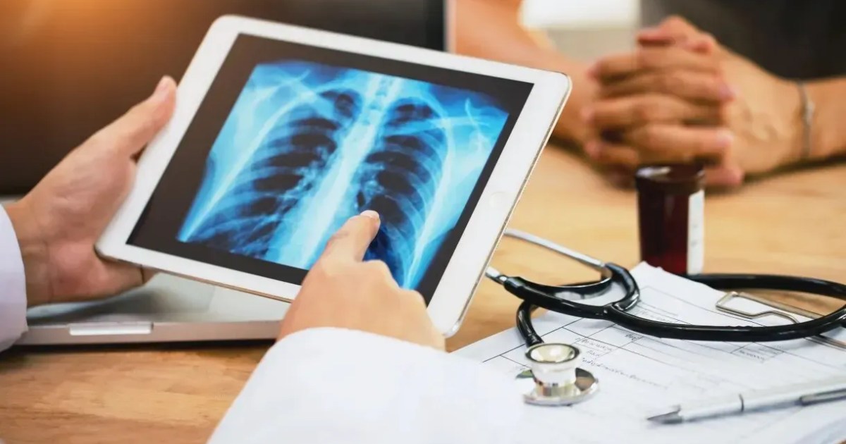 Dia mundial da tuberculose: novos antibióticos podem combater doença