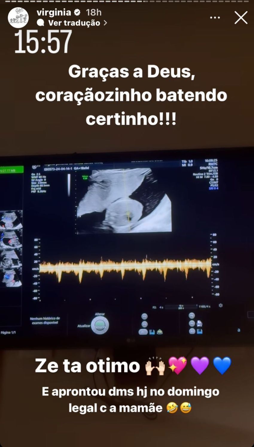 Virginia filmou batidas do coraçãozinho de seu bebê / Reprodução/Instagram