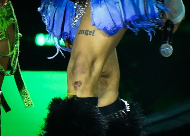 Pabllo Vittar se machucou após queda em show de Karol G / Leo Franco / AgNews