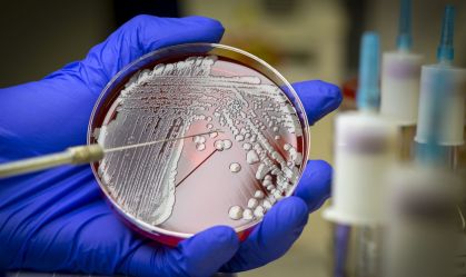 Resistência a antibióticos poderá matar mais de 39 milhões até 2050, diz estudo